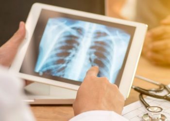 La tuberculosis es la principal causa de muerte de quienes viven con VIH en América Latina