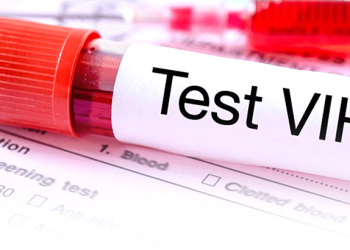 VIHSIBLE: expertos presentan Consenso Nacional sobre la atención del VIH en Colombia