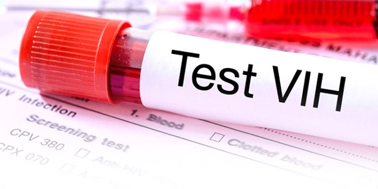 VIHSIBLE: expertos presentan Consenso Nacional sobre la atención del VIH en Colombia