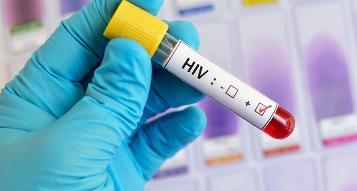 01 de diciembre Día Mundial de la Lucha contra el Sida