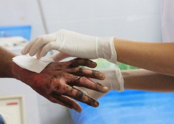 Nuevo llamado del Distrito: celebraciones con pólvora ponen en juego la vida