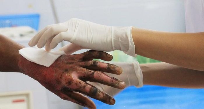 Nuevo llamado del Distrito: celebraciones con pólvora ponen en juego la vida