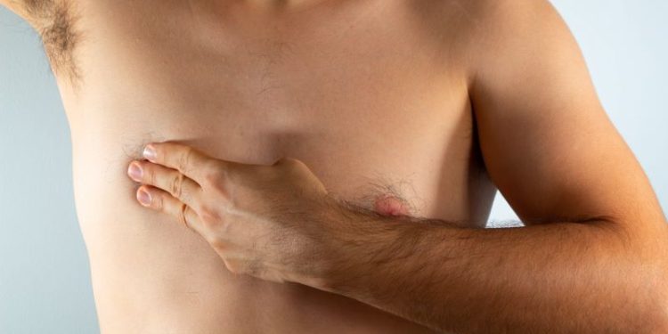 Cáncer de mama en hombres: Tener unos kilitos de más, podría ponerlo en riesgo