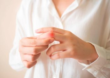 Lupus: “entendiendo la enfermedad y aprendiendo a vivir con ella”